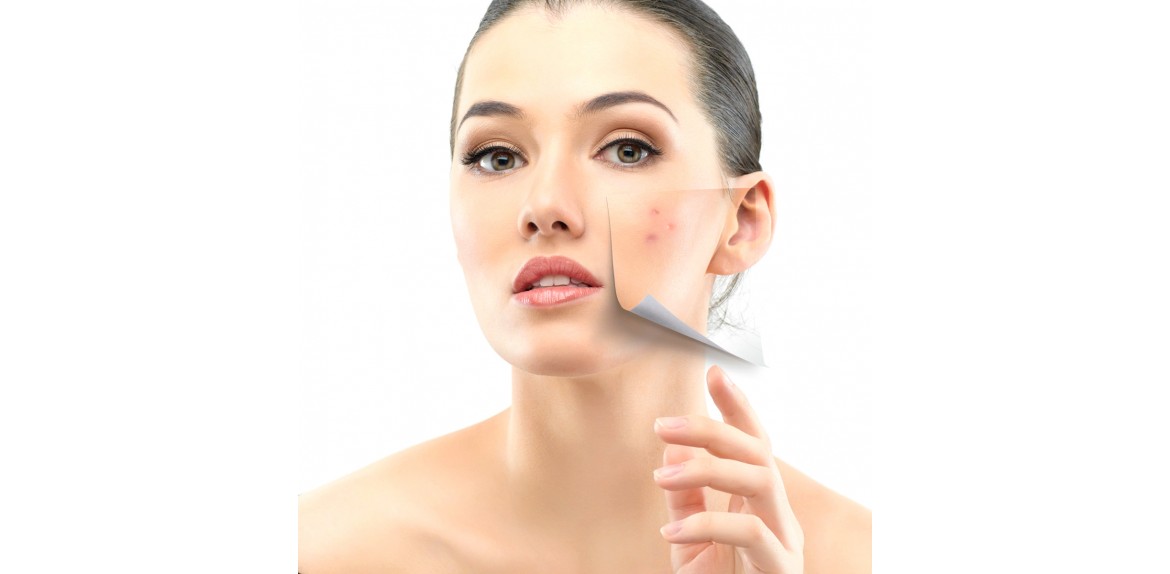 Microdermabrazyon